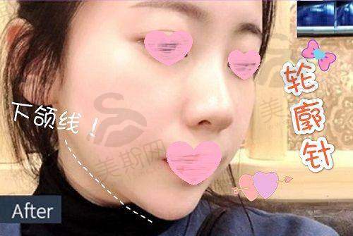 结语