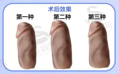 中山市人民医院光子嫩肤价格揭秘！含中山人民医院价格表，美容激光医生咋样也知晓！