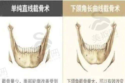 王珍详医生坐诊医院——重庆长城骨科医院