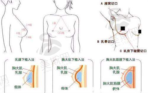 乌鲁木齐佳都俏臣医疗美容医院特色技术