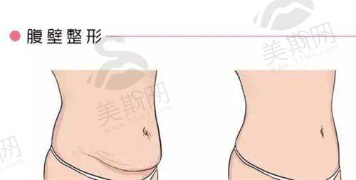 东莞泗安医院医学美容科热门项目