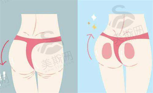 成都美茵医疗美容医院正规吗？