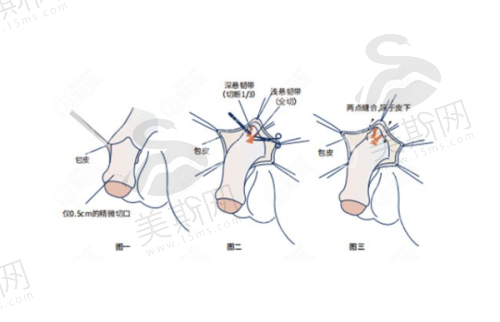 重庆松山何军鼻部整形核心技术