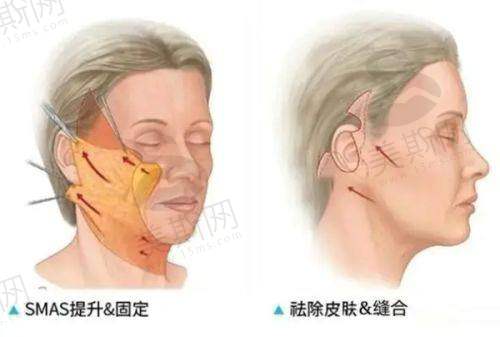 成都美茵医疗美容医院口碑如何