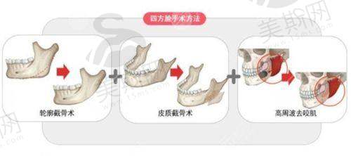 南宁帕拉美整形医院正规吗?