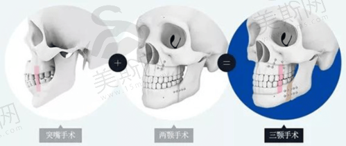 金岚副医生擅长项目