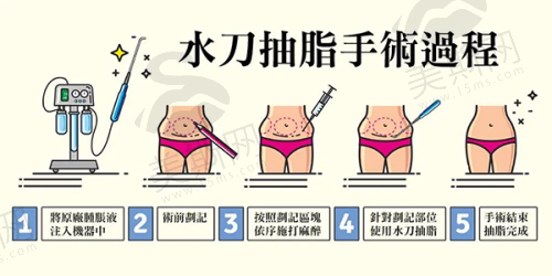 点阵激光注意事项