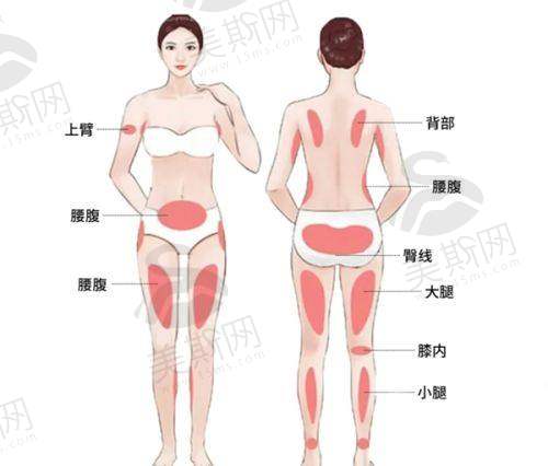 鼻部整形收费价格表