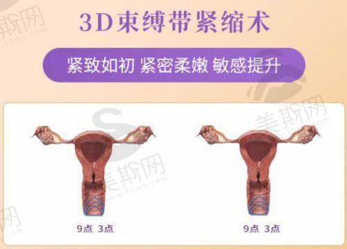 重庆长城骨科医院陈亮口碑评价及反馈实例