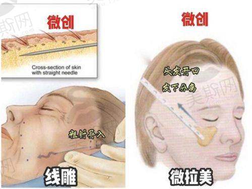 段艳军 医生技术水平高