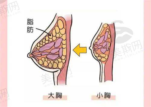 隆鼻心得