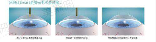 河北省二院眼科电话查询预约挂号