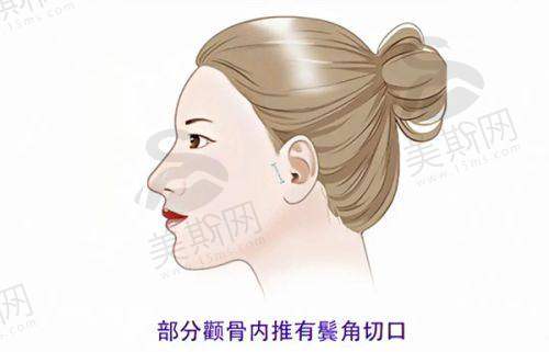 D&A皮肤科医院正规吗？