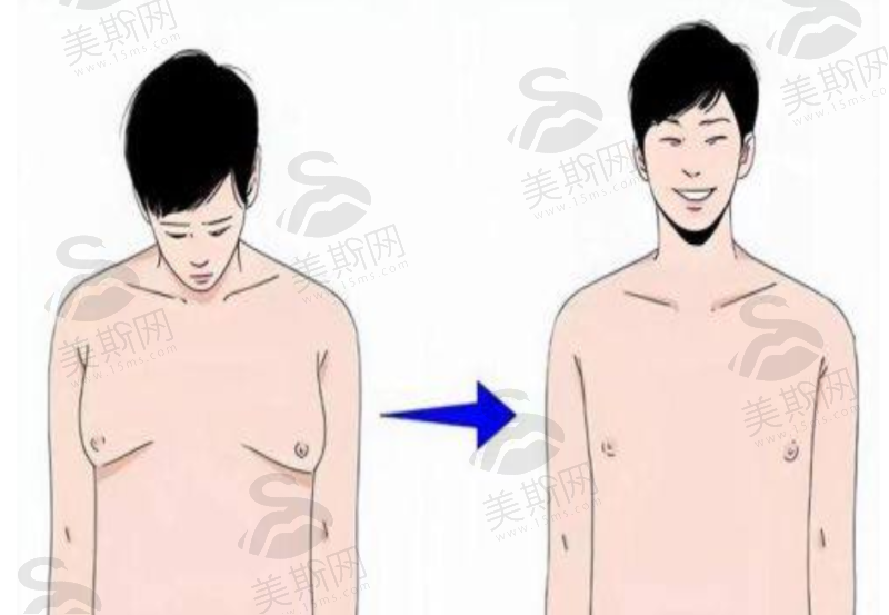 银川第一人民医院整形美容科预约挂号方式