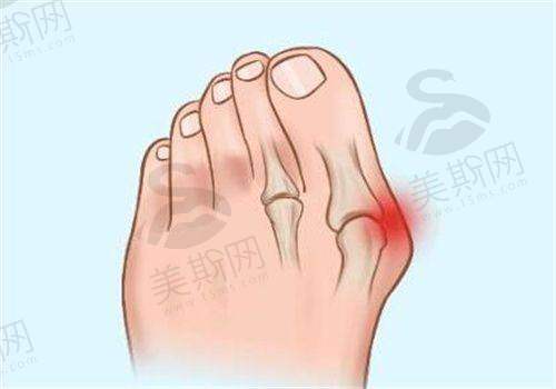 刘月更丰胸技术怎么样