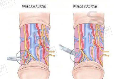 上海抽脂骨干医生
