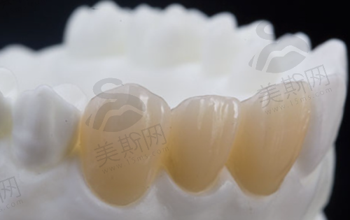 总结