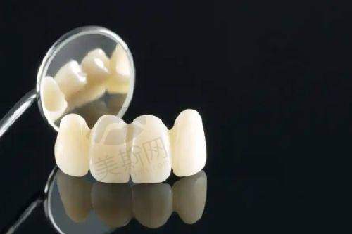 满口假牙价格2025：活动/吸附性义齿/种植牙2000-68000元