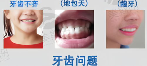 总结