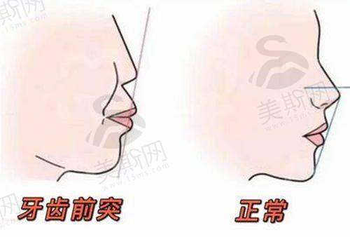 福州市正规连锁口腔——福州登特口腔
