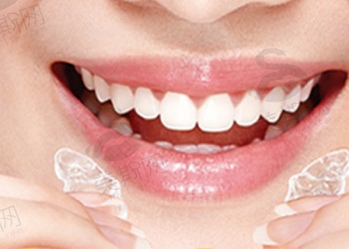 牙齿美容修复项目全攻略:从轻度着色到重度缺损解决方案