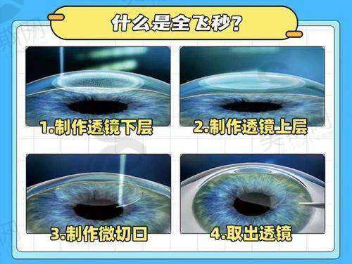 邢台市第九医院眼科（综合）