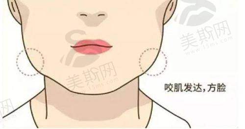 杜园园医生双眼皮修复手术过程和步骤图解