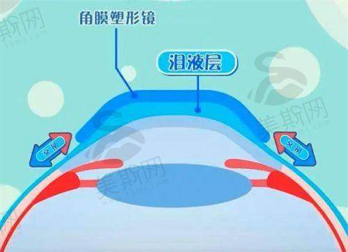 2025济南华视眼科医院近视手术价格表：含半飞秒/全飞秒/晶体植入费用(附医生推荐及预约指南)