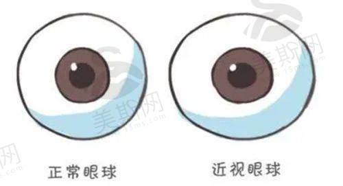 定期复查