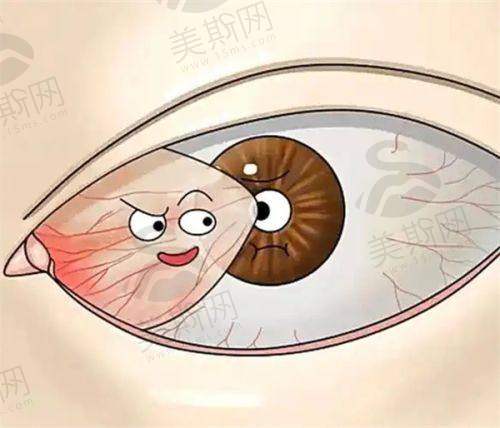 邢台眼科医院做近视眼手术更有具有影响力的医师