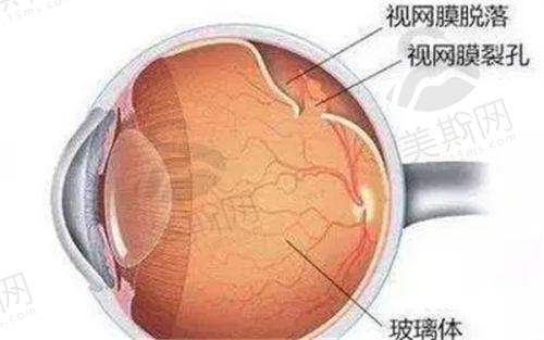 北京大学深圳医院眼科医生