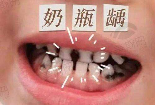 延庆看牙医院之患者评价参考