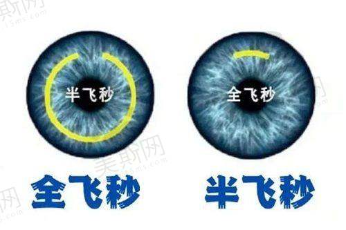 强生双焦点晶体价格：6000元起实现远/近视力自由