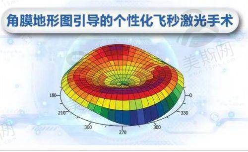 博士伦晶体A常数2025深度剖析：mi60型号参数如何选对人工晶体型号？