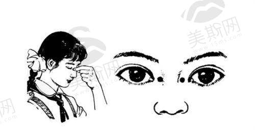 美国强生晶体植入成效怎么样从临床实例看真实体验