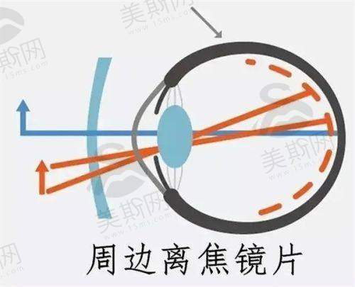 博士伦晶体A常数的测量方式与修正逻辑