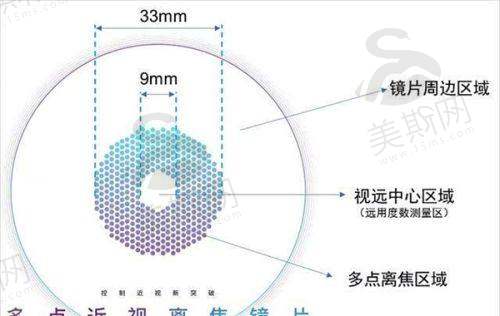蔡司人工晶体839度数怎么看？2025参数/a常数解析+适配人群参考指南