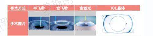 蔡司晶体属于什么档次的?2025人工晶体十大排名前三!术后成像清晰/稳定性好