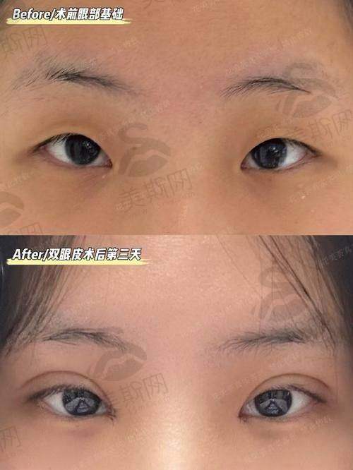 杨迪医生个人资历解密