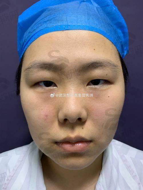 万字真人日记改编:三位受益者讲述重生体验
