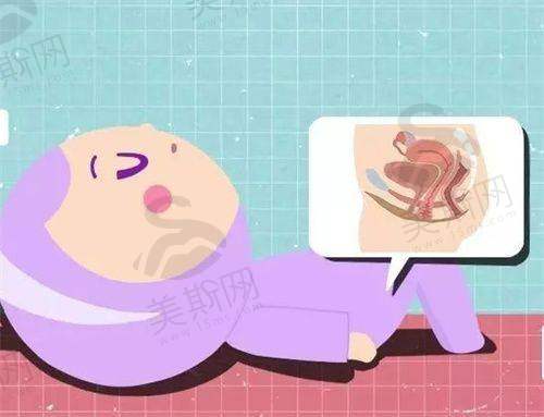 进口硅胶假体