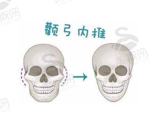 总结