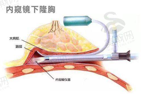 深圳十大正规整容医院排名公布表