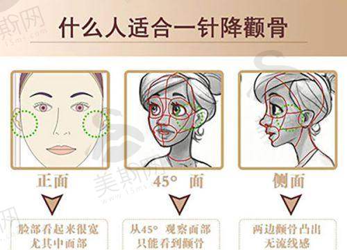第4名:上海江城疤痕修复中 心