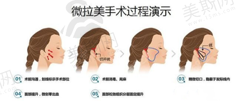第2名:上海虹桥医院疤痕科