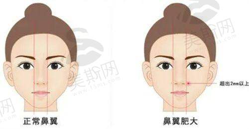总结