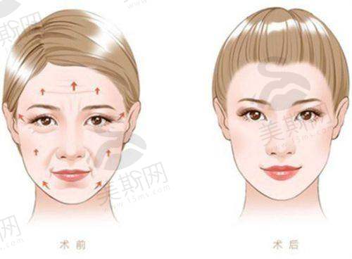 一、武汉艺星谭琳美杜莎星辰美眼12000元起：价格解析与项目特色