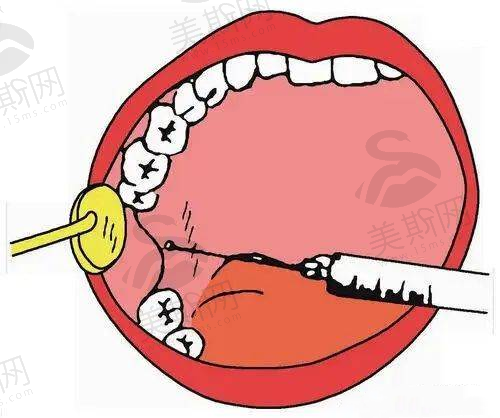 二、大连爱德丽格刘志刚修复双眼皮怎么样？2025年高难度修复实例见证实力
