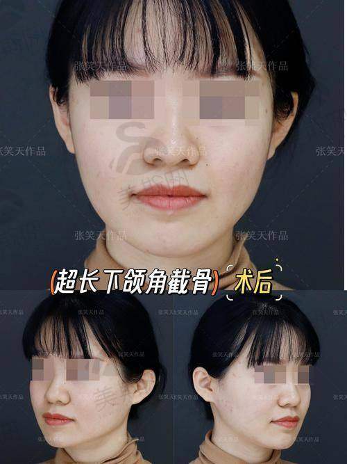 重庆松山医院：三等级综合医院背书，颌面整形更放心