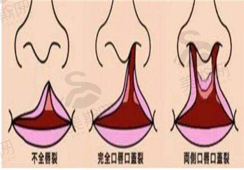 韩国reyou皮肤科医院诊疗项目